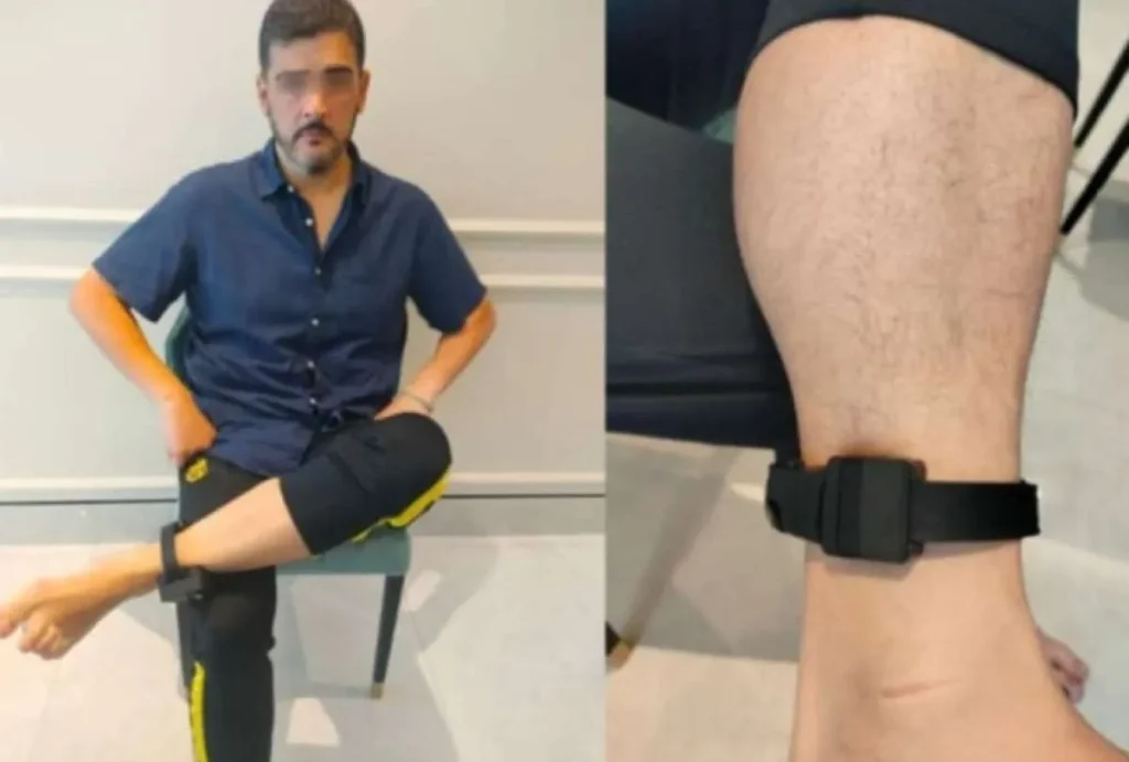 Correísmo y grillete electrónico: de impulso legal a símbolo de justicia